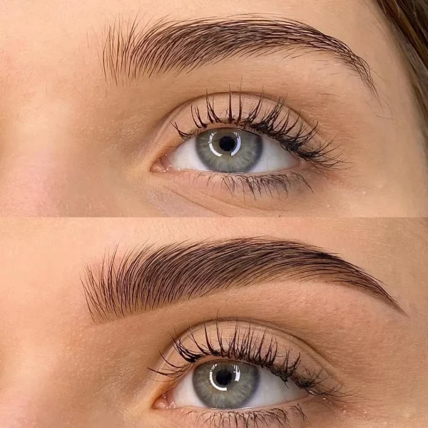 Wimpern_Browlift